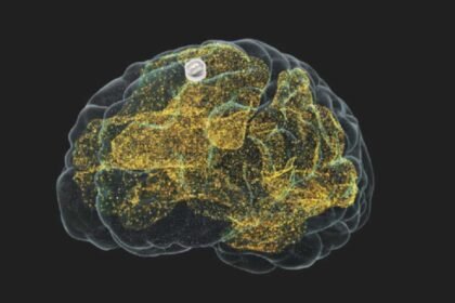 Implante cerebral